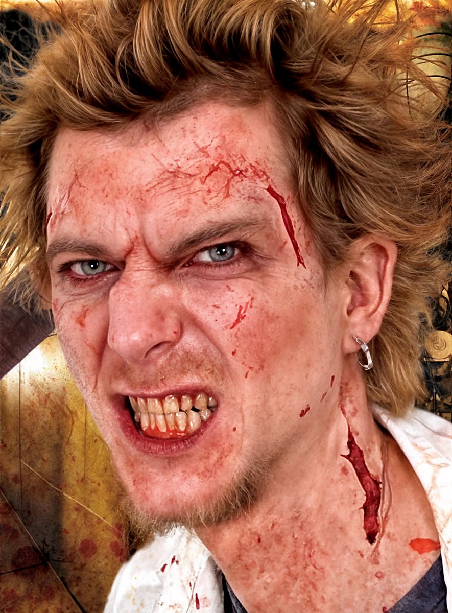 Plaies de viande de rage en latex