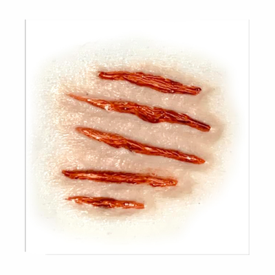 Transferencia de heridas en la mejilla 3D herida