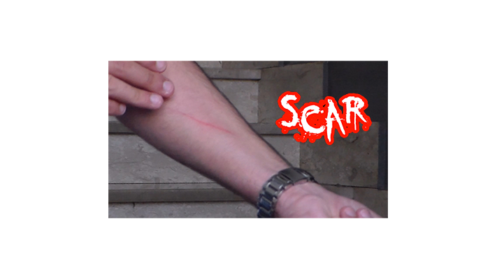 SCAR by Dan Alex - - Video Download Alessandro Criscione bei Deinparadies.ch