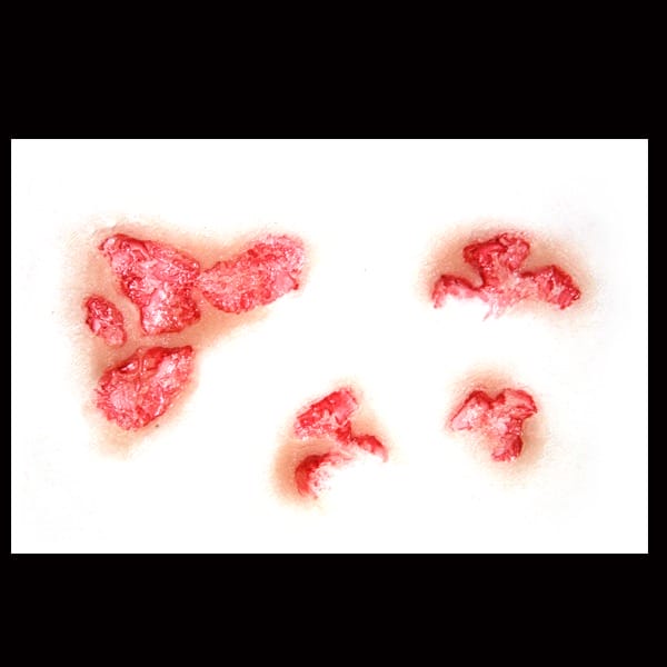 Wundtransfer 3D Burned Flesh-Tinsley Transfers-Deinparadies.ch