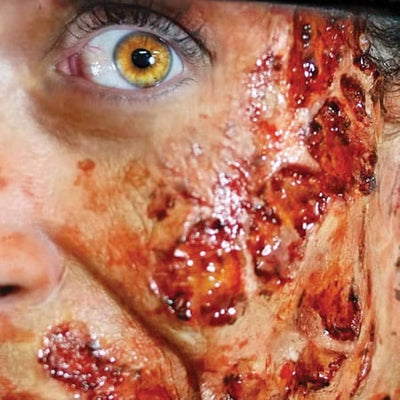 Wundtransfer 3D Burned Flesh