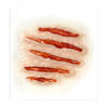 Transferencia de heridas en la mejilla 3D herida