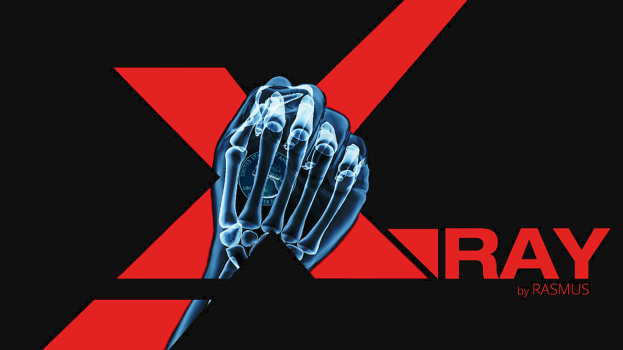 X-Ray by Rasmus Rasmus Magic bei Deinparadies.ch